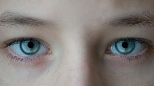 Cienie i zapadnięcia pod oczami – skąd się biorą i jak je rozumieć?