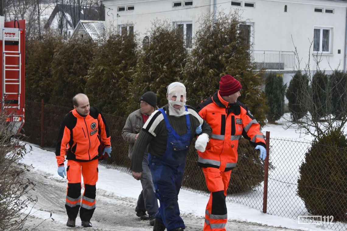 Lubatówka: Pożar garażu. Właściciel ratując dobytek doznał poparzeń