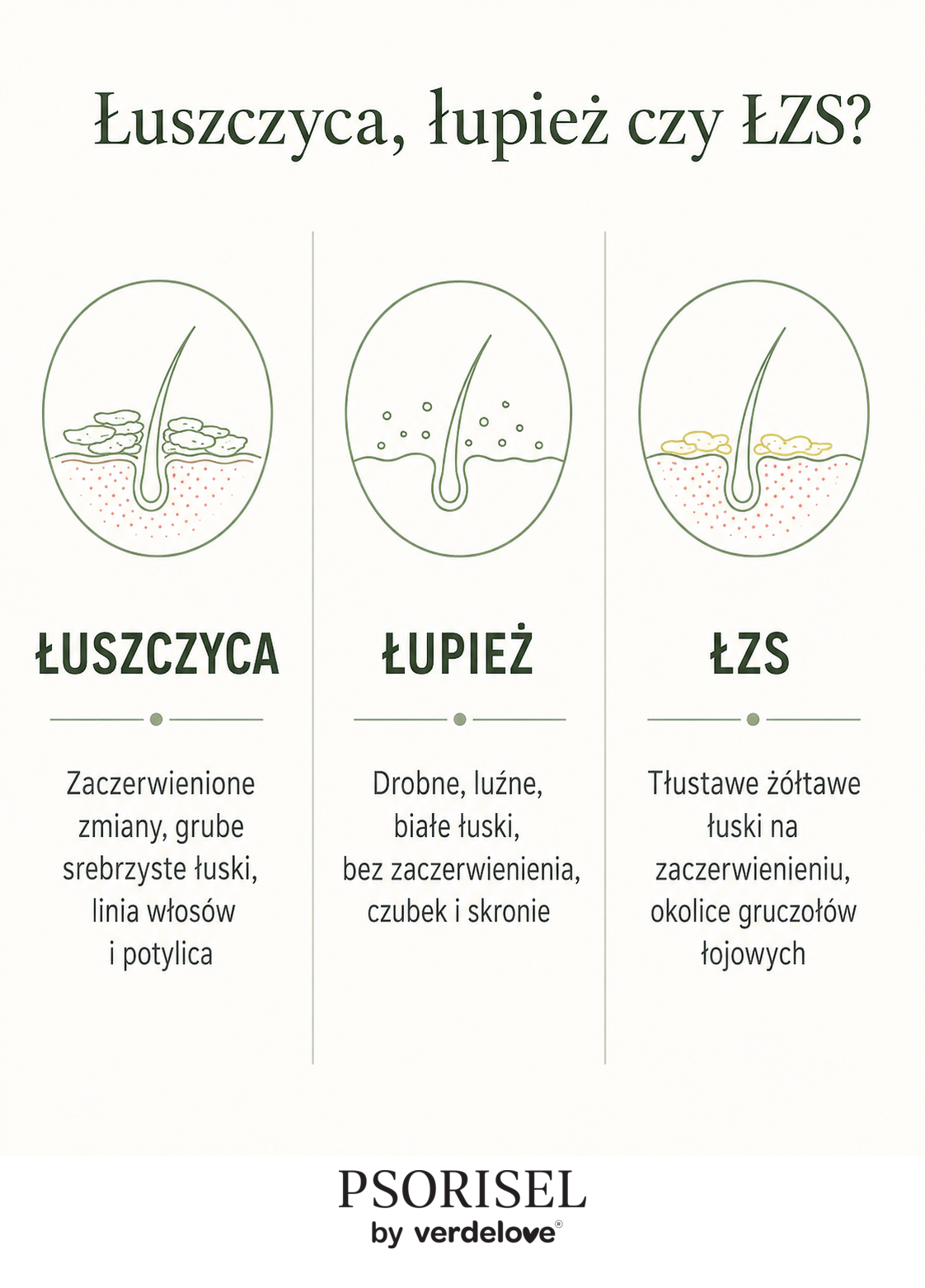 Porównanie objawów łuszczycy, łupieżu i łojotokowego zapalenia skóry głowy